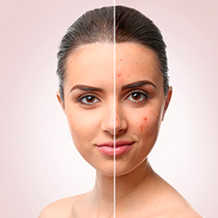 skin & laser treatment