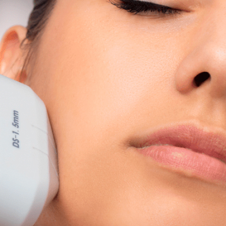 Is HIFU Treatment a Viable Alternative to Face Lifts?