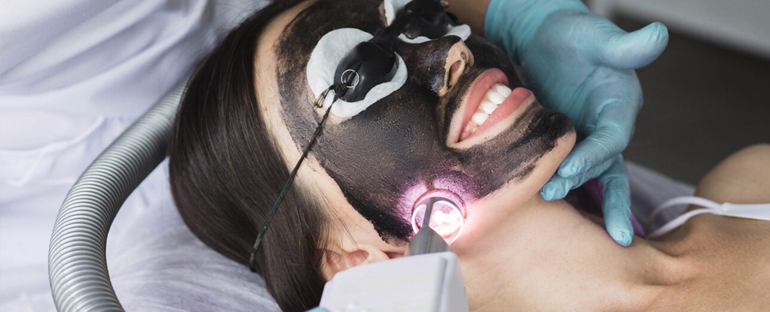 Unveiling the Secrets of Laser Carbon Peels: Your Complete Guide